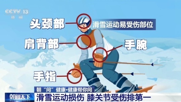 防摔跤 冬季滑雪请收下这份安全指南！千亿球友会首页朝“问”健康丨选护具、(图2)